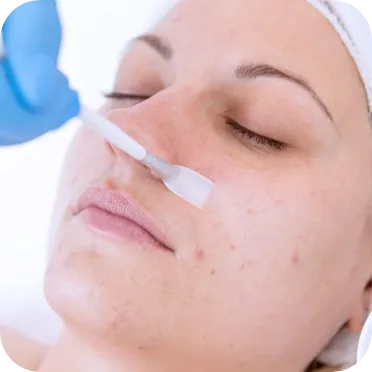 Acne Clean Up