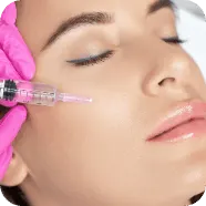 PRF Vampire Facial