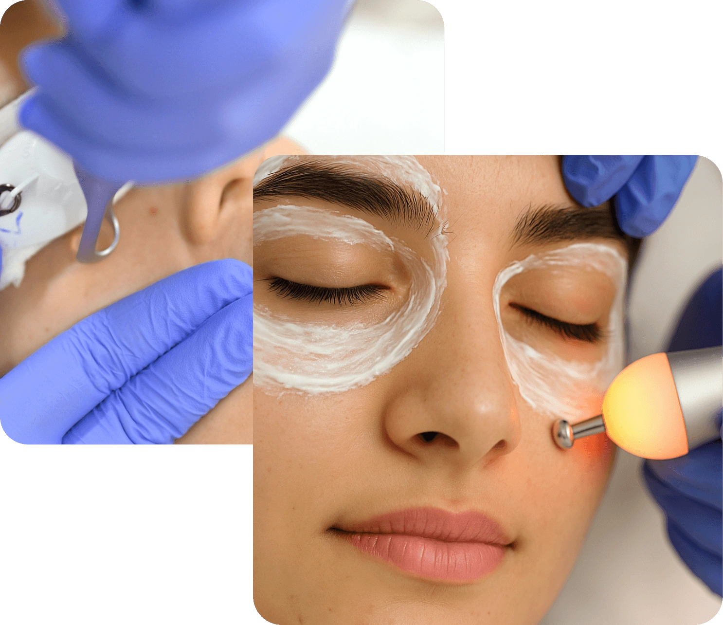 NeoiRejuve Advanced RF technology for under-eye