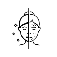 refined skin texture under eyes